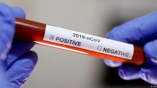 الصحة: لا وفيات و403 إصابات جديدة بكورونا و224 حالة تعافٍ خلال أسبوع