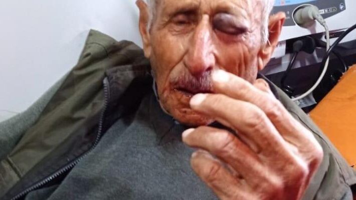 إصابة مسن بكسور ورضوض جراء اعتداء مستوطنين عليه