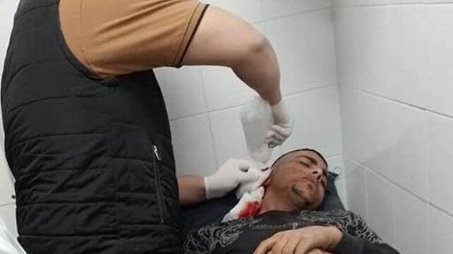 محافظات: إصابة عاملين برصاص الاحتلال ومستوطنون يعتدون على شاب