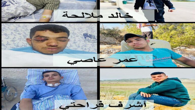 الاحتلال يتسبب بفقدان 3 أطفال لأعينهم منذ بداية العام الجاري