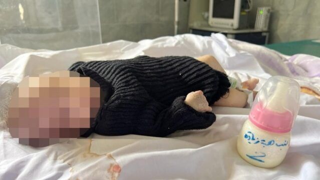 ارتفاع عدد الأطفال المتوفين بسبب سوء التغذية في غزة إلى 16