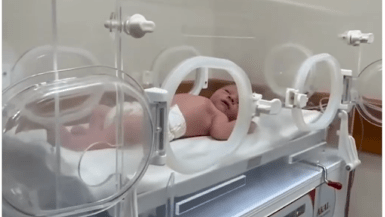 غزة: مستشفى العودة ينجح في إنقاذ جنين من رحم والدته الشهيدة