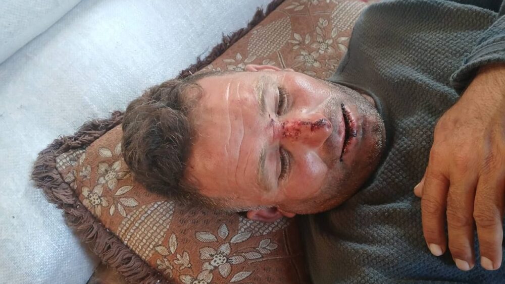 مستوطنون يعتدون على مواطن ويسرقون 250 رأساً من الأغنام في عقربا