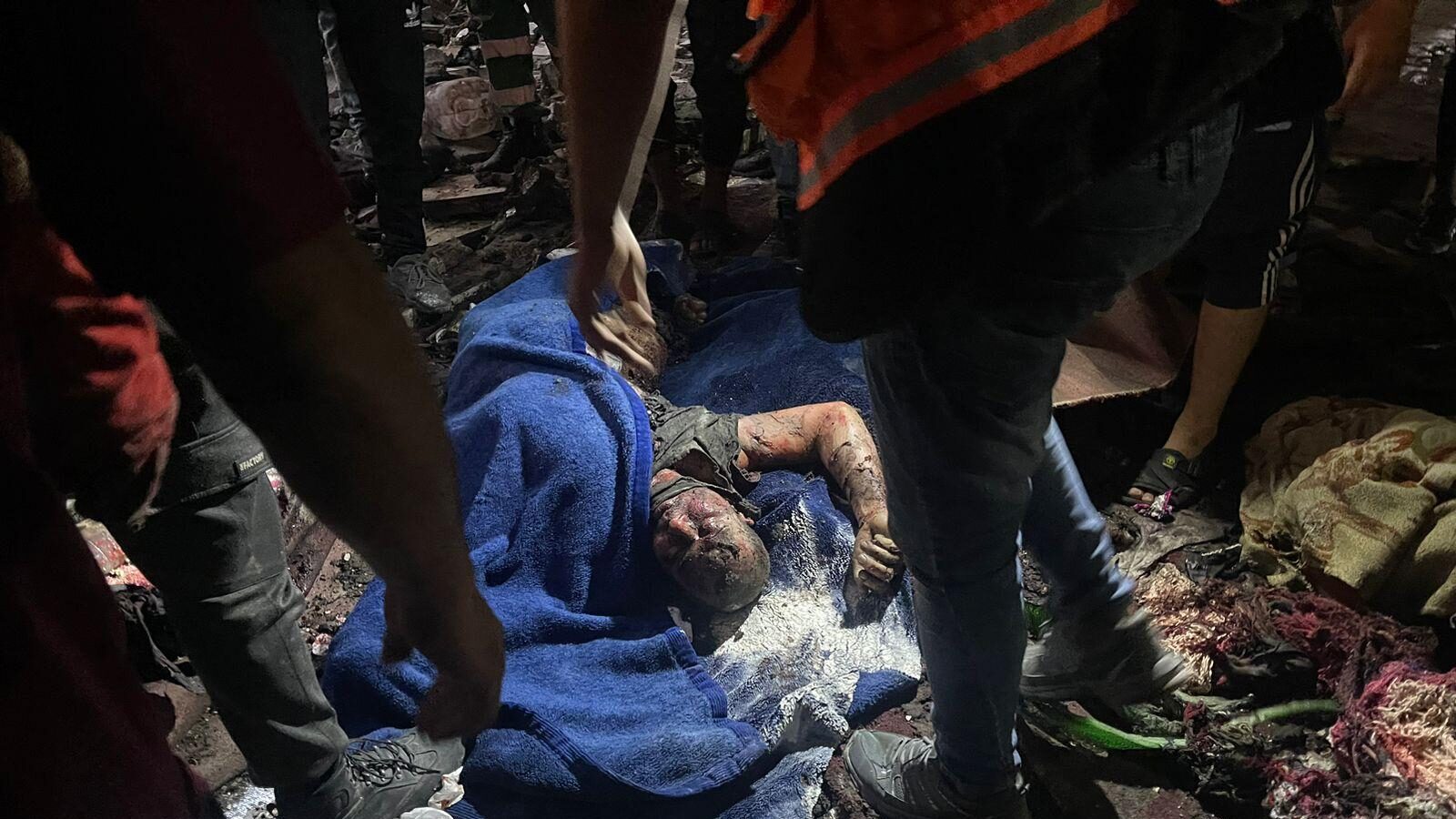 11 شهيدًا ومصابون في قصف الاحتلال مناطق متفرقة في قطاع غزة