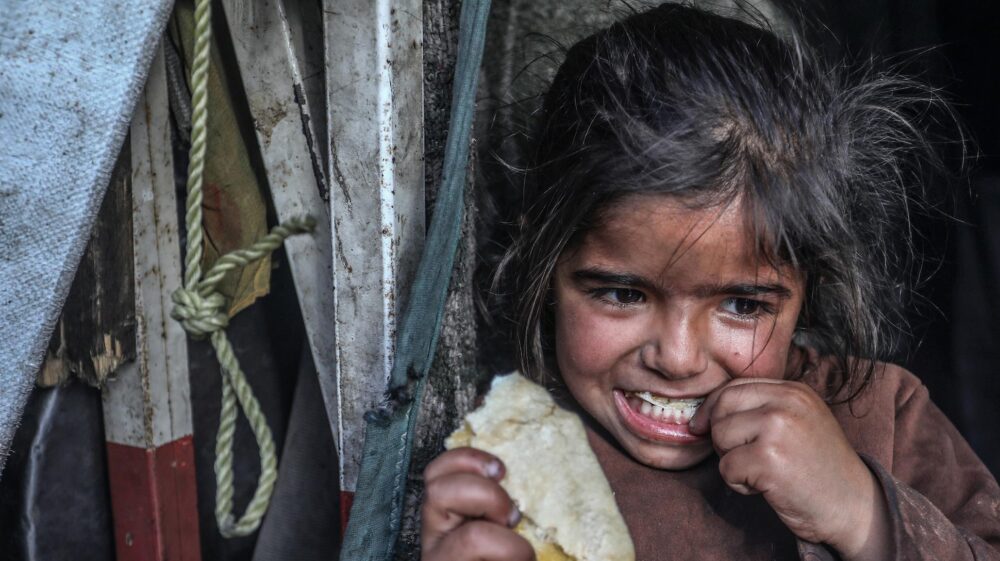 "الأونروا": 66 ألف طفل في قطاع غزة يعانون سوء تغذية خطيراً