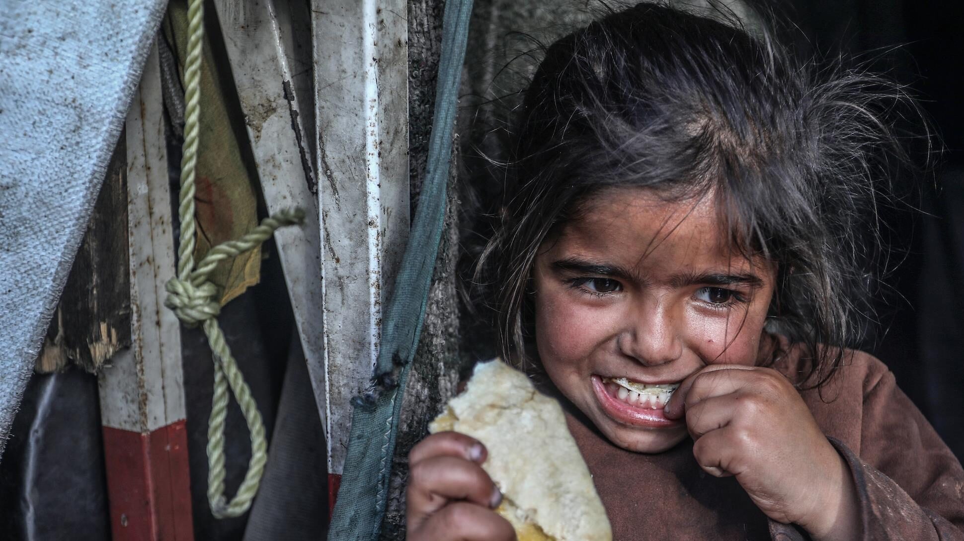 "الأونروا": 66 ألف طفل في قطاع غزة يعانون سوء تغذية خطيراً