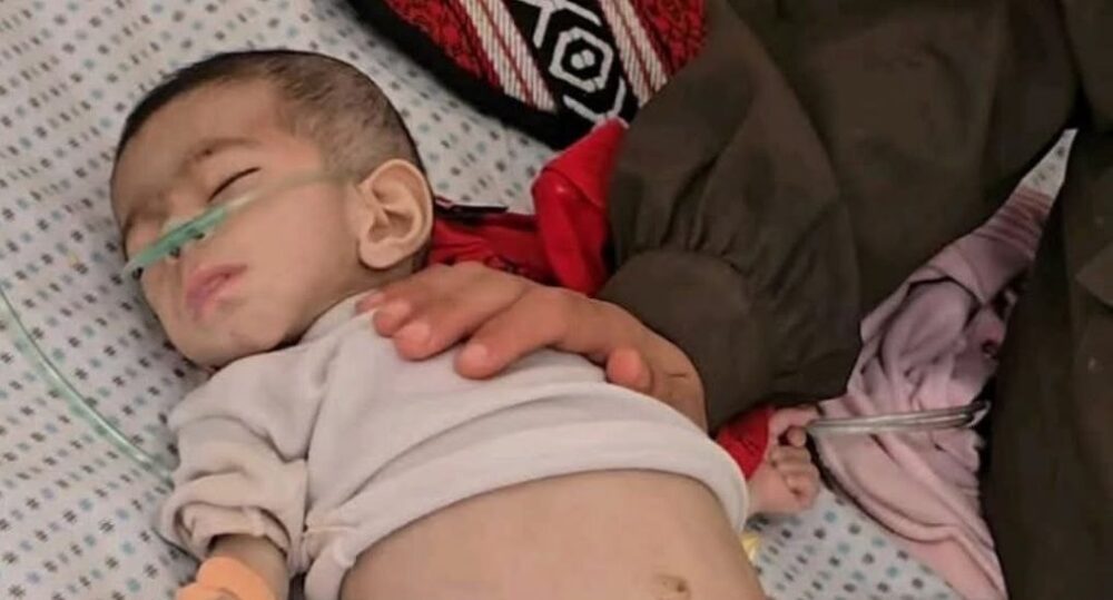 ارتفاع الشهداء جراء سوء التغذية إلى 54... وفاة طفلة في مدينة غزة