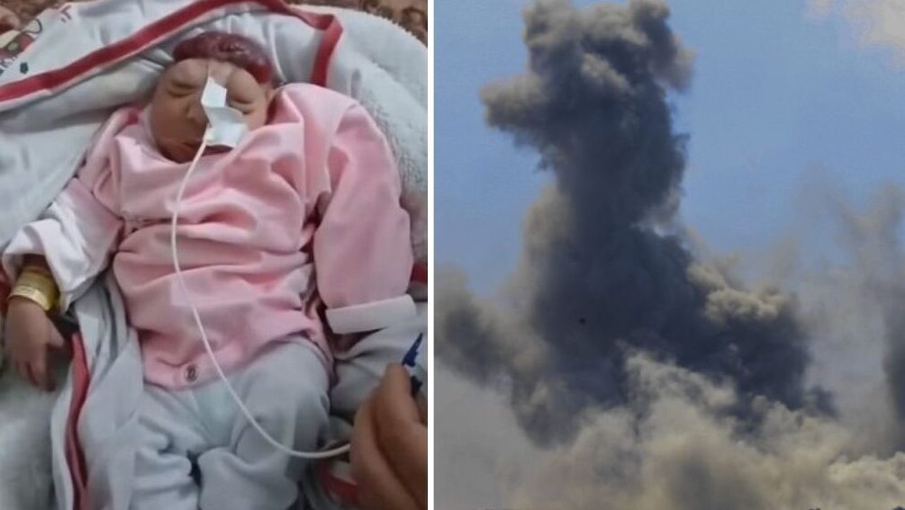 ولادة طفلة "بلا دماغ" مع تزايد ظاهرة "تشوه الأجنة" في قطاع غزة