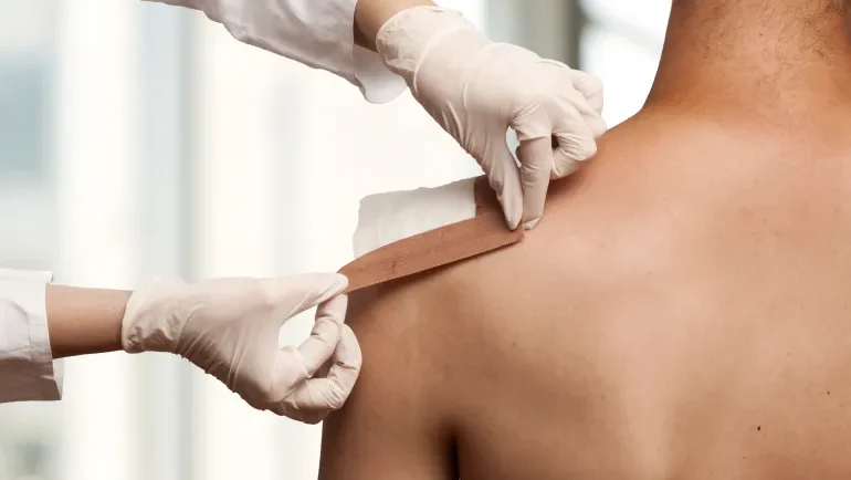 جيل جديد من بدائل الجلد يمنح الأمل لمرضى الحروق