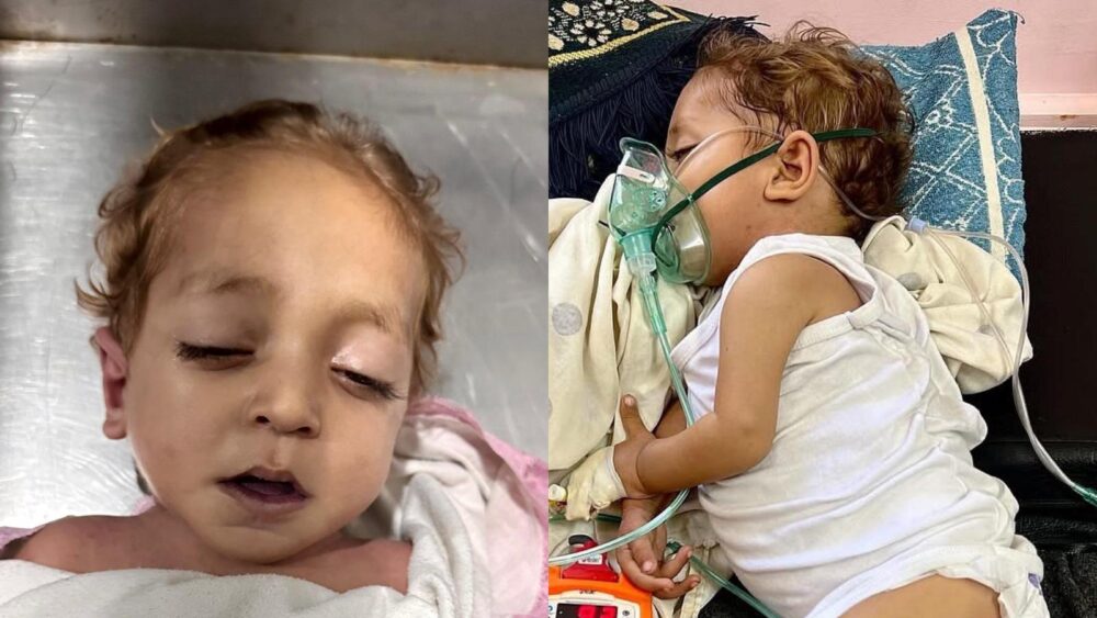 وفاة طفل من قطاع غزة نتيجة حرمانه من العلاج