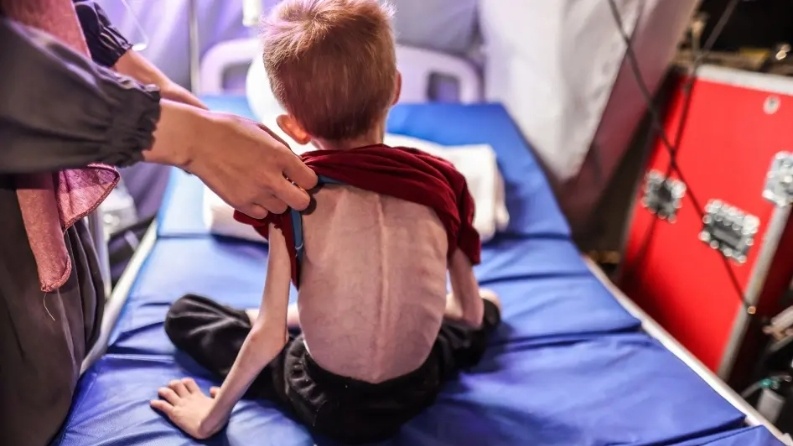 112 طفلا يدخلون مستشفيات غزة يوميا بسبب سوء التغذية