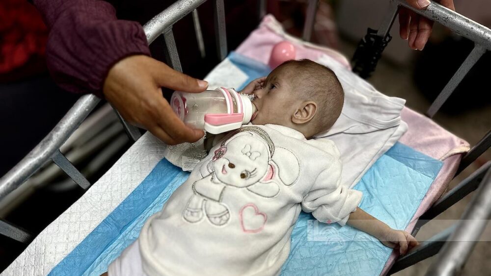 "الأونروا": طفلاً من كل 10 أطفال في غزة يخضعون للفحص يعاني من سوء التغذية