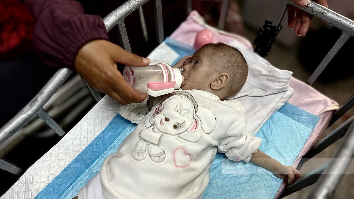 "الأونروا": طفلاً من كل 10 أطفال في غزة يخضعون للفحص يعاني من سوء التغذية