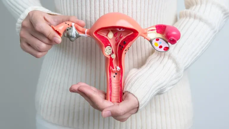 الكشف عن جين يجعل سرطان المبيض أكثر عدوانية