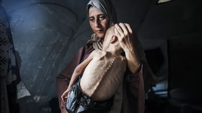 عظام من غزة