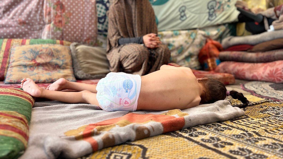 المجاعة وسوء التغذية المجاعة وسوء التغذية