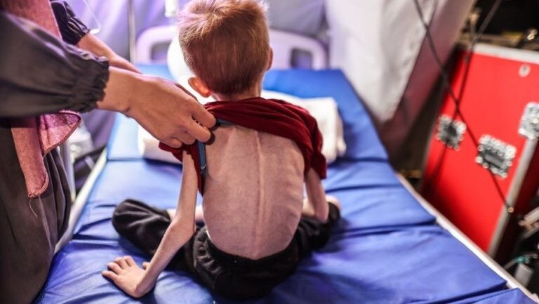 الصحة بغزة: استشهاد 11 مواطناً نتيجة المجاعة وسوء التغذية خلال الـ 24 ساعة الماضية