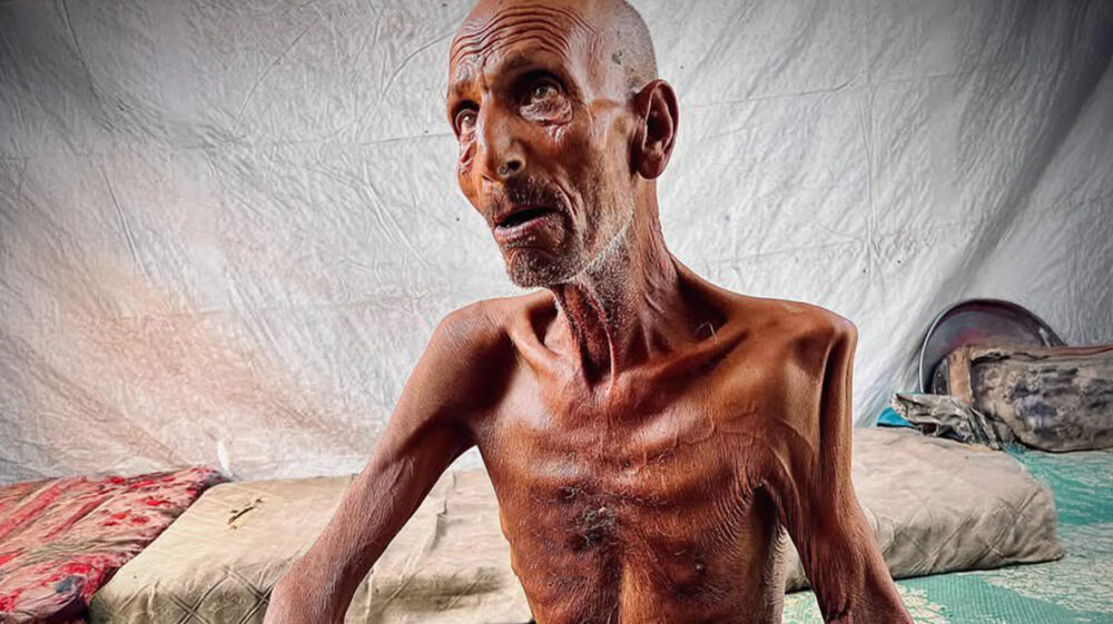 وزنه حوالي 40 كيلو غراماً ... مؤذن فلسطيني يصارع الموت جوعًا في قطاع غزة