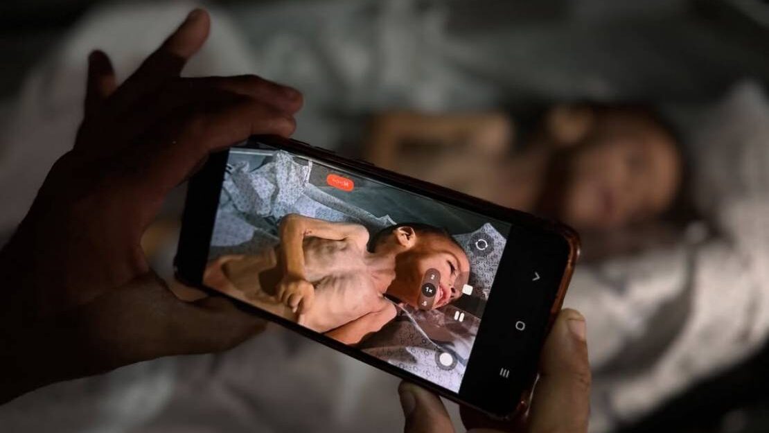 المكتب الإعلامي يفنّد مزاعم الاحتلال بعدم وجود سياسة تجويع