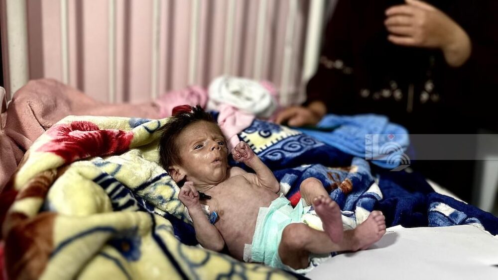 3 وفيات نتيجة التجويع وسوء التغذية في غزة خلال الـ24 ساعة الماضية