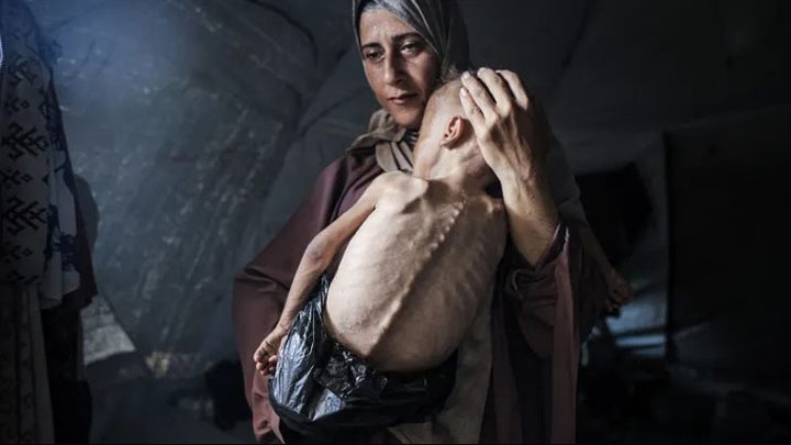 13 حالة وفاة بينها 3 أطفال نتيجة التجويع في غزة خلال الساعات الـ24 الماضية