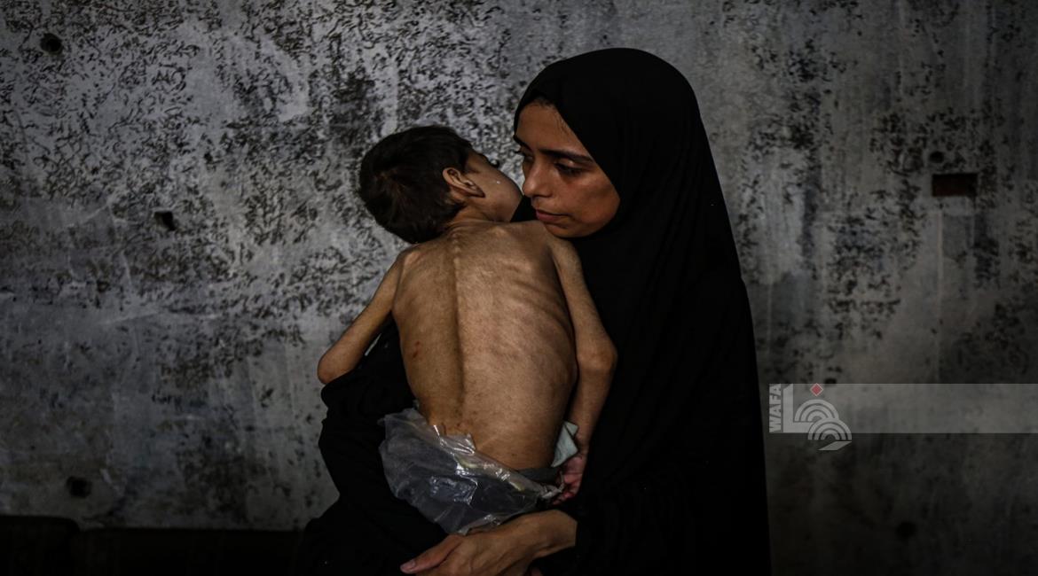 5 وفيات من بينهم 3 أطفال نتيجة المجاعة وسوء التغذية خلال الـ24 ساعة الماضية