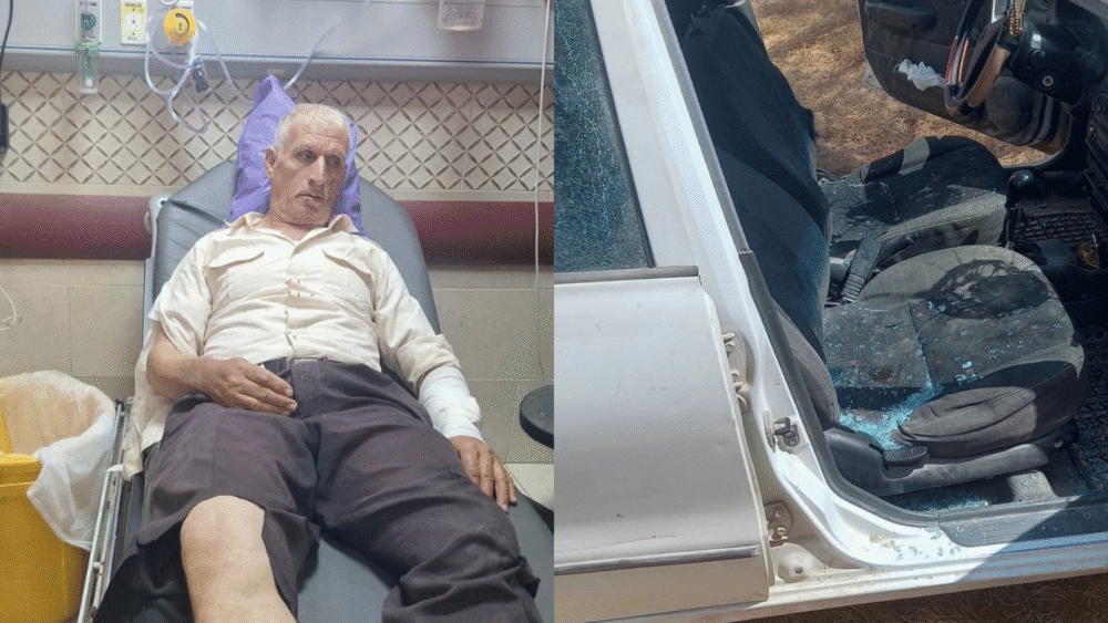 إصابة مواطن جراء اعتداء المستوطنين عليه غرب نابلس