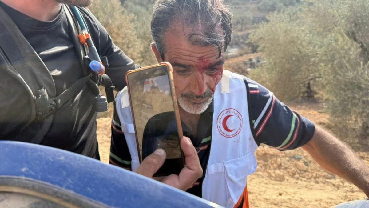 إصابة 4 متضامنين أجانب في هجوم للمستوطنين في تجمع عين الديوك بأريحا