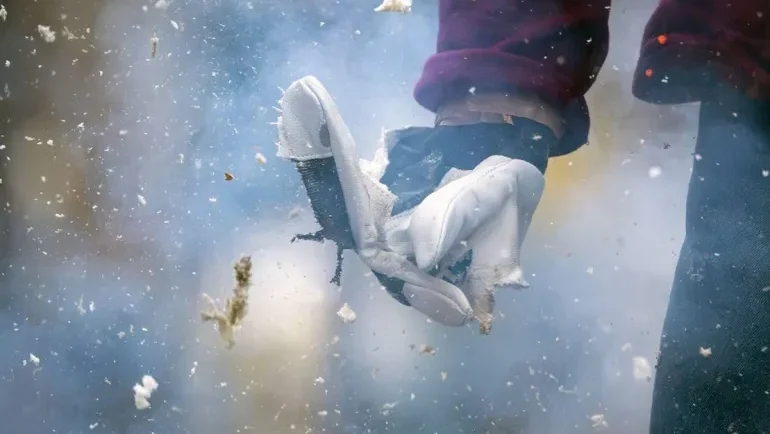 ‫الإسعافات الأولية للإصابات بالألعاب النارية