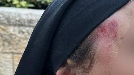 إصابة راهبة باعتداء مستعمر في القدس المحتلة