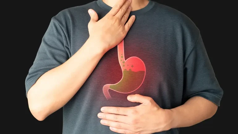 من حالة بسيطة إلى مرض قاتل.. الوجه الخفي لمريء باريت