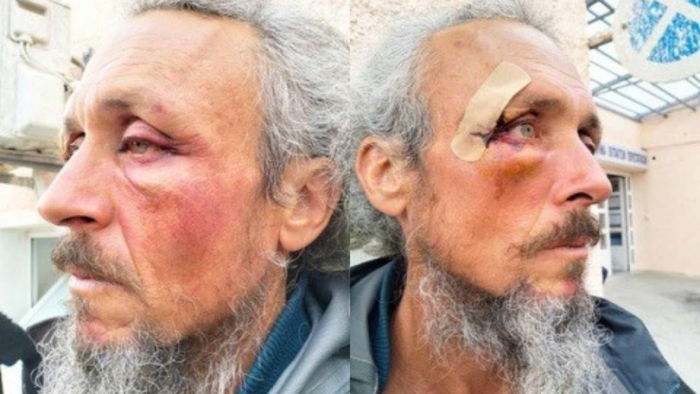 ضرب وتجويع وسوء معاملة: إصابة 31 ناشطاً خلال العدوان الإسرائيلي على "أسطول الصمود"