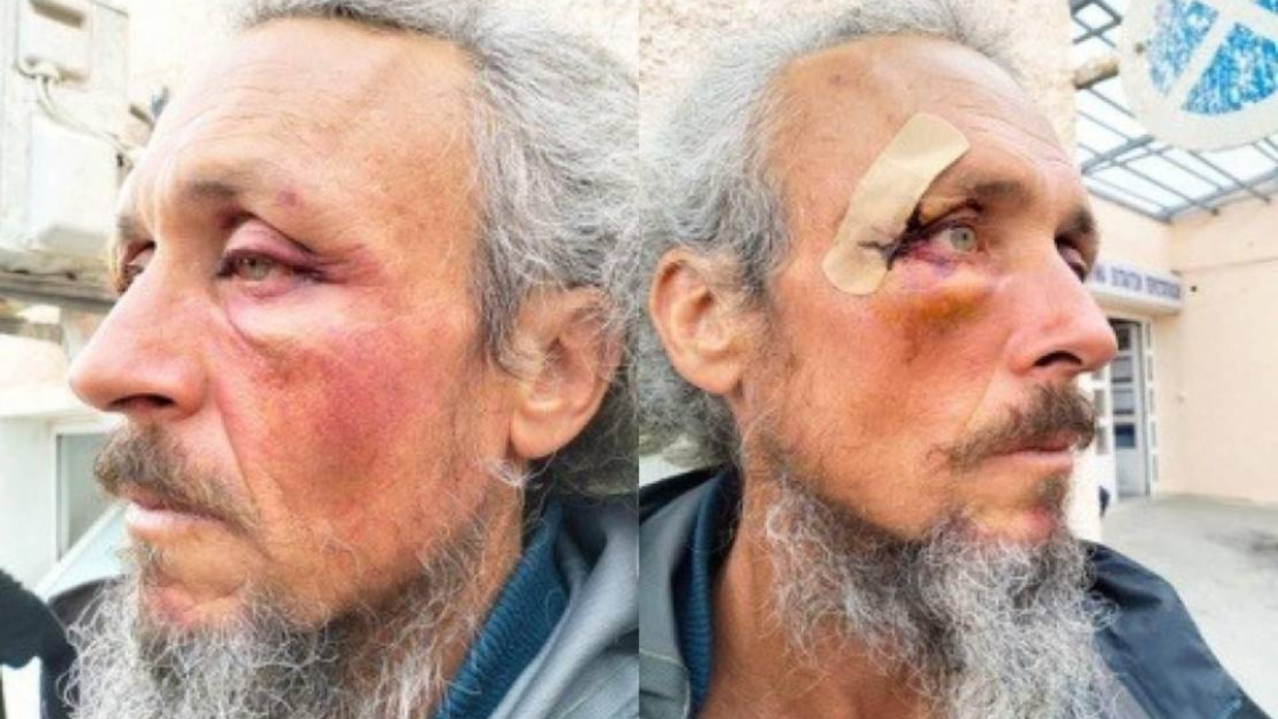 ضرب وتجويع وسوء معاملة: إصابة 31 ناشطاً خلال العدوان الإسرائيلي على "أسطول الصمود"