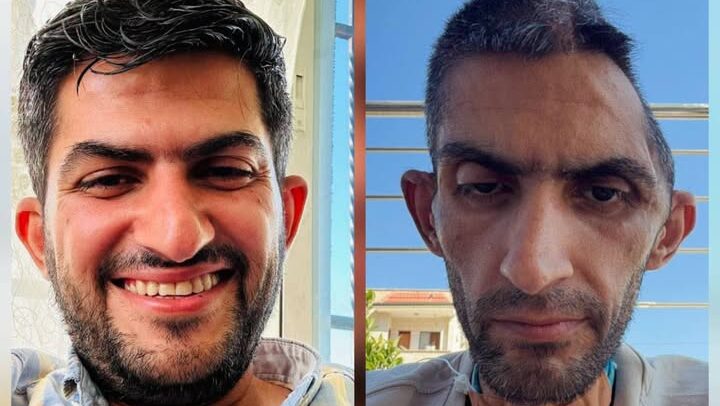 "الخبز كان حلمًا".. مجاهد بني مفلح: تجربة اعتقال وعلاج حفرت في الروح قبل الجسد